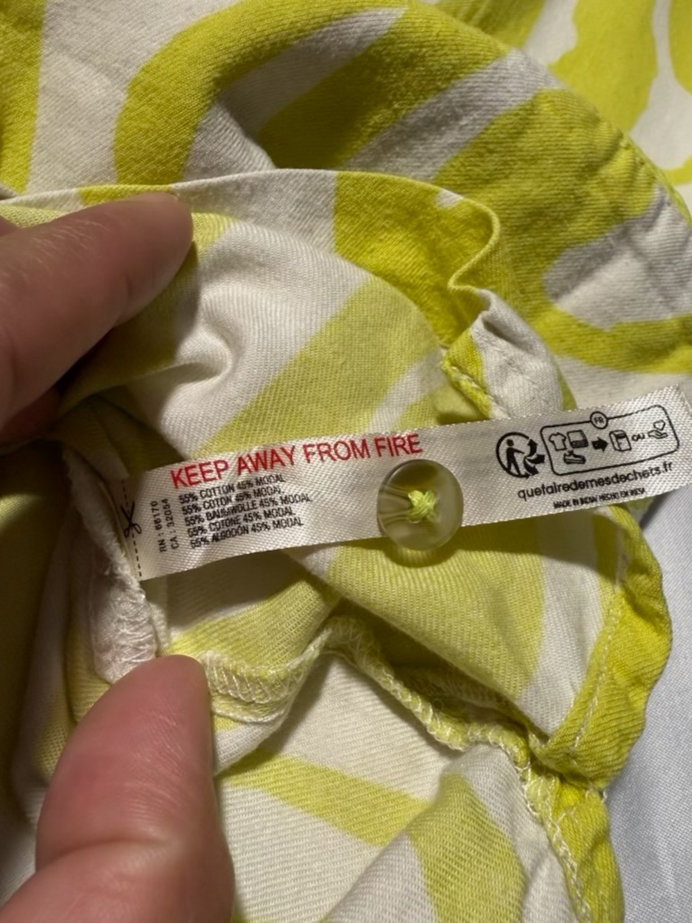 Anthropologie 2-piece Pajama Set Yellow White Zebra Print Button Top & Pants SzM - Picture 6 of 13